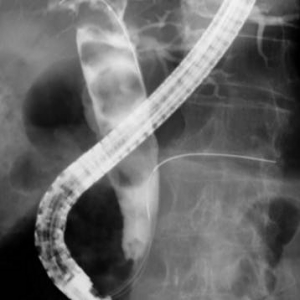 ercp1.jpg