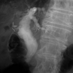 ercp6.jpg